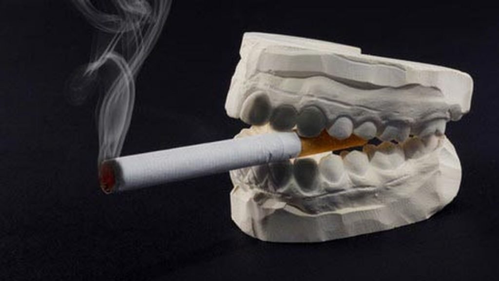 Kebiasaan Buruk Membahayakan Gigi Yang Mudah Dicegah