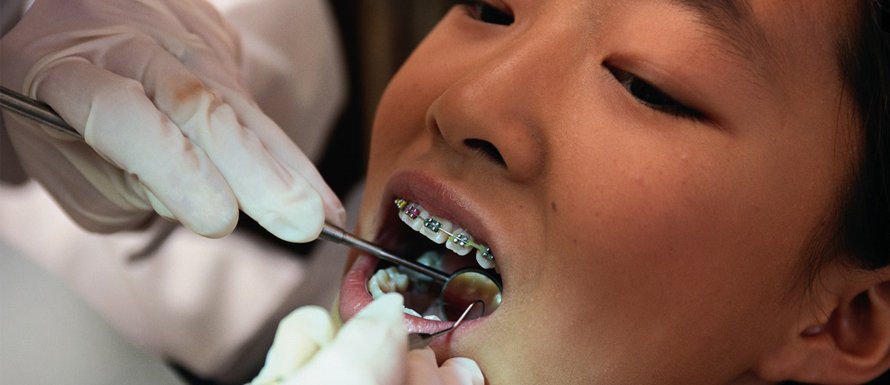 Mengatasi Masalah Gigi pada Remaja Panduan untuk Orangtua