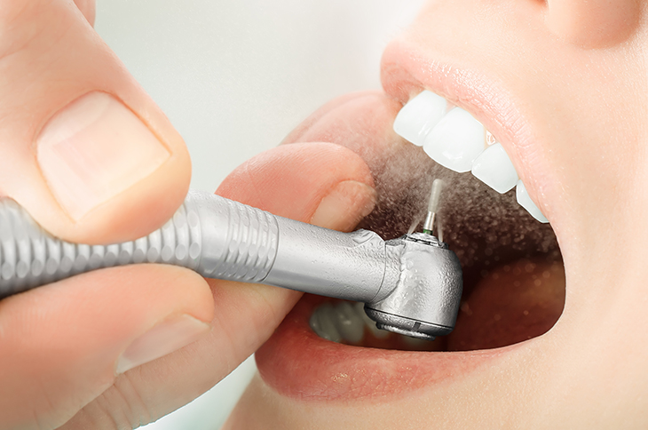 Inovasi Terkini dalam Perawatan Gigi yang Harus Ketahui