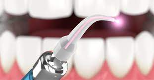 Teknologi Canggih dalam Dunia Kedokteran Gigi