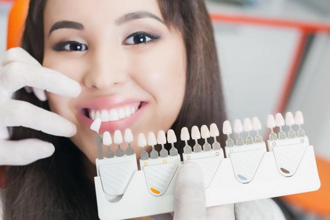 Fakta dan Mitos tentang Pemutihan Gigi yang Perlu Diketahui
